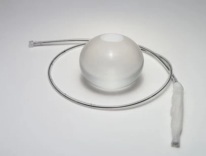 Your Weight Loss Journey with Gastric Balloon Surgery image